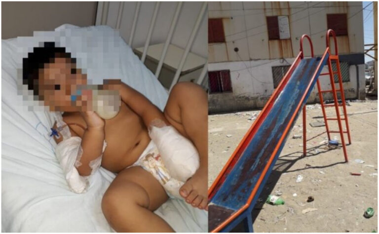 A un nene de 2 años tuvieron que amputarle un dedo tras accidentarse en un tobogán