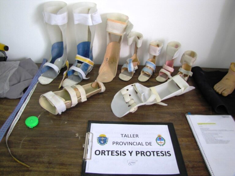 Un taller en el Hospital de Gaiman  fabricará Prótesis y Ortesis para pacientes de Chubut