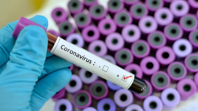 Son 34 los muertos por coronavirus y hay 72 pacientes en terapia intensiva