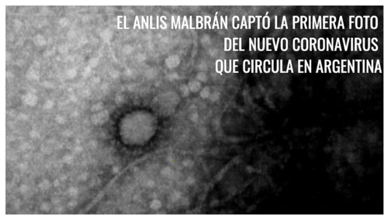 El Malbrán y UBA Conicet lograron imágenes a nivel microscópico del Covid19
