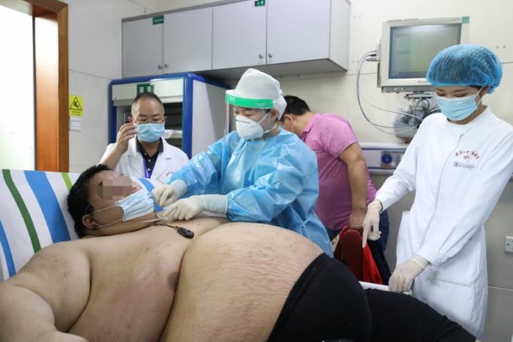 Coronavirus: Un hombre engordó 100 kilos durante la cuarentena