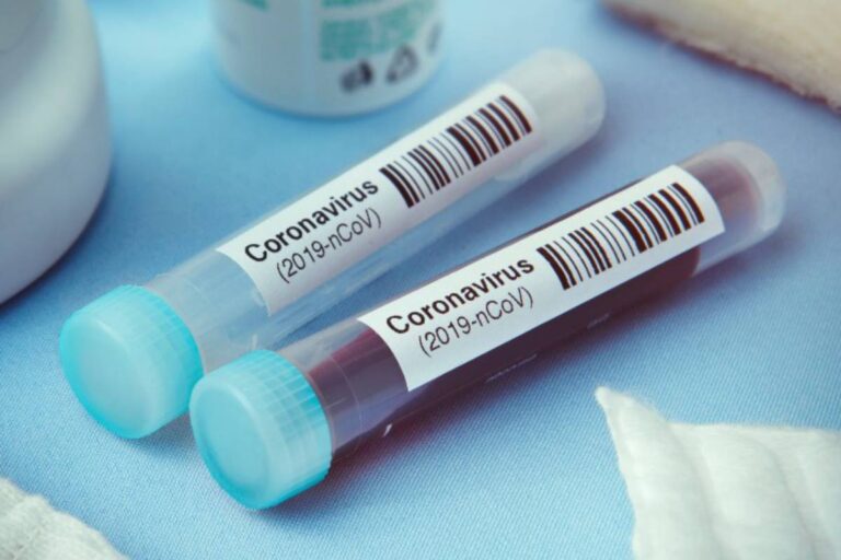 Advierten que se corrió la fecha del pico de casos de coronavirus en Argentina
