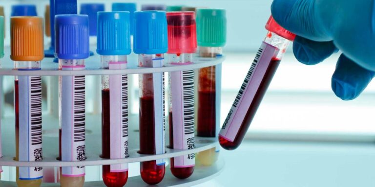 Una científica argentina creó un kit para detectar el cáncer de mama y de próstata