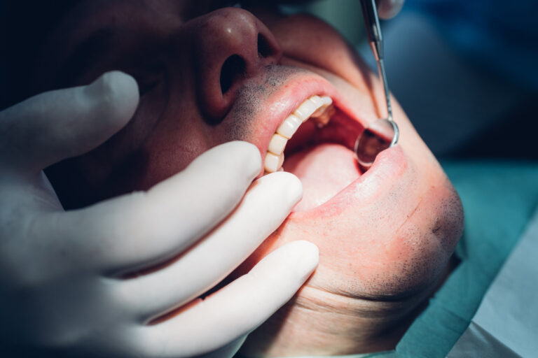 Caída de dientes sin dolor: estudian una nueva secuela del coronavirus